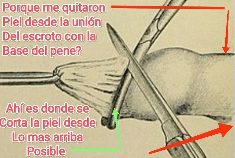 la circuncision es un fraude